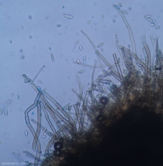 The short, dark, branched conidiophores bear the non-septate to bicloisonne ramoconidia.  <b> <i> Cladosporium cucumerinum </i> </b> (leaf spot or gray leaf spot, cucumber scab, cucumber scab