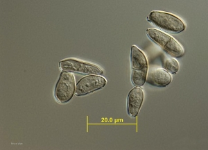 Cladosporiose-Tomate-WATT1