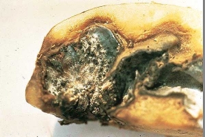 Dry gangrene-type rot <i><b>Phoma</i> sp.</b> with black pycnidia in internal tuber cavities
