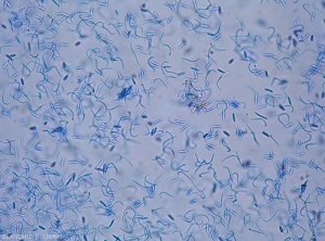 Mixture of beta spores and less alpha spores of <b> <i> Phomopsis viticola </i> </b> 