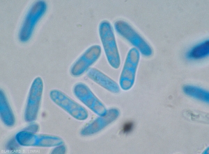 Colletotrichum10