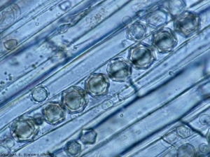 <b> <i> Olpidium brassicae </i> </b> stellate cysts have developed in several cells of the cortex.