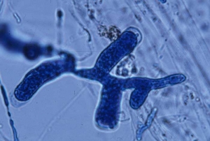 Swollen filamentous sporangium of <b> <i> Pythium aphanidermatum </i> </b> ("damping-off")