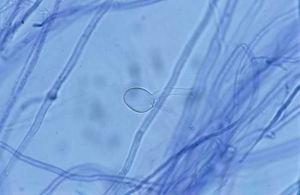 Globular sporangium of <b> <i> Pythium </i> sp. </b> ("damping-off")