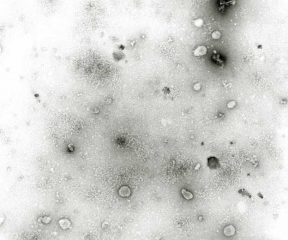 The particles of <b> <i> Mirafiori lettuce big-vein virus </i> </b> (MLBVV, lettuce large vein virus) are difficult to observe under electron microscopy.