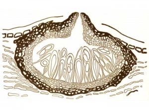 Cut through a perithecium of <b> <i> Botryosphaeria obtusa </i> </b>, a fungus involved in BDA (black dead arm) disease.