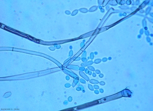 cladosporium3