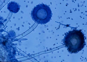 Aspergillus5