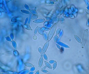 Aspecto de conidios  <b><i>Cladosporium cucumerinum</i></b>. (cladosporiosis).