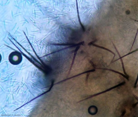 Aspecto de varios acérvulos de <i> <b> Colletotrichum orbiculare </b> </i> observados al microscopio óptico.  (antracnosis)