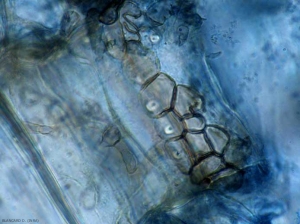 Un contorno de microesclerocios de <b> <i> Colletotrichum coccodes </i> </b> que se forman en una célula de la corteza.