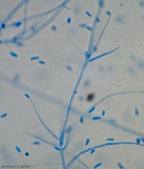 Detalle de un conidióforo de <b> <i> Verticillium dahliae </i> </b>. Un conidio todavía está presente al final. (marchitez por Verticillium, <i> Verticillium </i> marchitez).