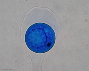 Ascus que contiene una sola ascospora esférica todavía hialina.  <i> <b> Monosporascus </i> sp. </b>