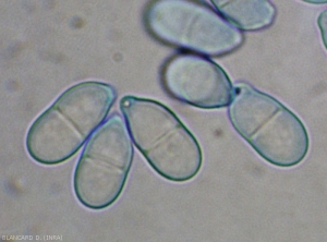 Detalle de conidios de <i> <b> Trichothecium roseum </b> </i>.  