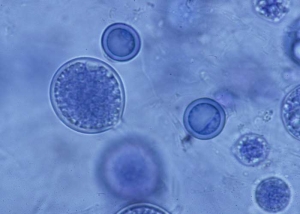 <b> <i> Pythium tracheiphilum </i> </b> produce esporangios de globulares a subglobulares, intercalares o terminales, que varían en diámetro de 22 a 34 µm.