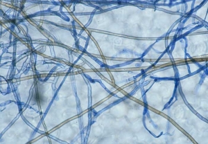 Rhizoctonia395