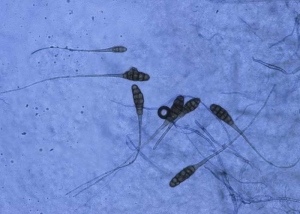 Alternaria185