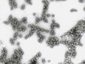 Partículas de virus isométricas de aproximadamente 29 nm de diámetro.<b><i>Cucumber mosaic virus</i></b>, CMV.