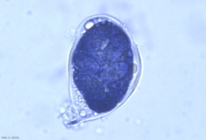 Un ascus de <b> <i> Erysiphe necator </i> </b> puede contener de 2 a 8 ascosporas.