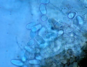 Des conidies hyalines, ellipsoïdes à ovales, mesurant 16-29 x 6-9 µm ont pu être extraites en pressant une pycnide. <b><i>Macrophomina phaseolina</i></b>