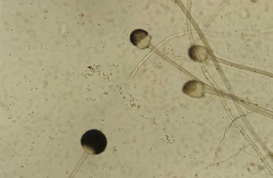 Quelques sporangiophores de <b><i>Rhizopus</i> sp</b>.; sur certains d'entre eux, la vésicule sporifère s'est déchirée, libérant de nombreuses spores.