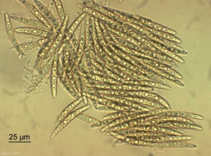 leptosphaeria_colza3