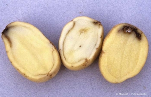 Nécrose au talon et brunissement de l'anneau vasculaire sur tubercules de pomme de terre, lié à un défanage dans certaines conditions (par forte chaleur, sur plantes déshydratées...)