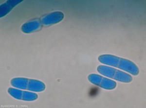 Détail au microscope photonique des conidies cloisonnées et bicellulaires de <b><i>Phoma cucurbitacearum</i></b>.  (forme anamorphe)(pourriture noire, black rot)