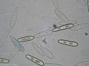 Aspect de divers conidies  de <b><i>Leveillula taurica</i></b> observées au microscope photonique. Les premières conidies formées sont plus ou moins lancéolées et pointues à leur extrémité. Les secondes sont plus ou moins ellipsoïdales à cylindriques. Leurs mensurations sont variables : 30-80 x 12-22 µm. (oïdium, powdery mildew)