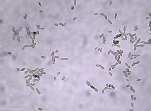 Cladosporium-Giraud3