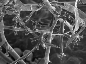 Détail des stérigmates présents à aux extrémités des sporangiophores arbusculeux et sur lesquels sont formés les sporanges.  (vue au microscope à balayage) <i>Plasmopara viticola</i> <b>Mildiou de la vigne</b> (Nathalie PICHON)