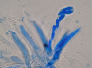 Bouquet d'asques de <i>Didymella bryoniae</i> ; dans l'un d'entre-eux on distingue 8 ascospores allongées.   (forme téléomorphe)(pourriture noire, black rot)