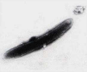 <b><i>Pectobacterium carotovorum</i> subsp. <i>carotovorum</i></b> est une bactérie Gram -, en forme de bâtonnet et pourvue de flagelles péritriches (pourriture bactérienne, <i>bacterial stem rot and fruit rot</i>).