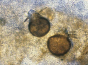 Pyrenochaeta478