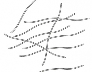 Particules virales flexueuses de 15nm de diamètre et d'environ 750 nm de long (type potyvirus). <b>Virus de la mosaïque nécrotique de la chicorée</b> (<i>Endive necrotic mosaic virus</i>, ENMV) 