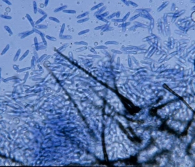 Nombreuses conidies hyalines de <i><b>Colletotrichum orbiculare</b></i> ; elles sont unicellulaires, oblongues à ovoïdes, mesurant 4-6 x 13-19 µm. (anthracnose)