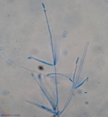 Gros gros plan sur quelques conidiophores de <b><i>Verticillium dahliae</i></b> à l'extrémité desquels sont encore présentes des conidies ellipsoïdes de ce champignon.(verticilliose, <i>Verticillium</i> wilt).