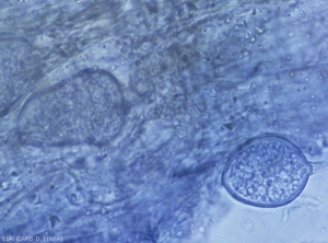 Phytophthora-sporanges