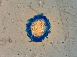 Amas de pycnidiospores sorties d'une pycnide d'un <i>Phoma</i> sp. responsable de la criblure du taro.