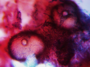 Aspect des pycnides globuleuses de <i>Neofusicoccum parvum</i>. On distingue bien leur ostiole circulaire.