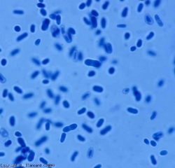 The pycniospores are smooth and hyaline, oblong to ellipsoid, even obovoid, uni or bicellular.  Their dimensions vary from one conidium to another (3-11 x 2-4.5 µm).  <b> <i> Didymella lycopersici </i> </b> (<i> Didymella </i> chancre)